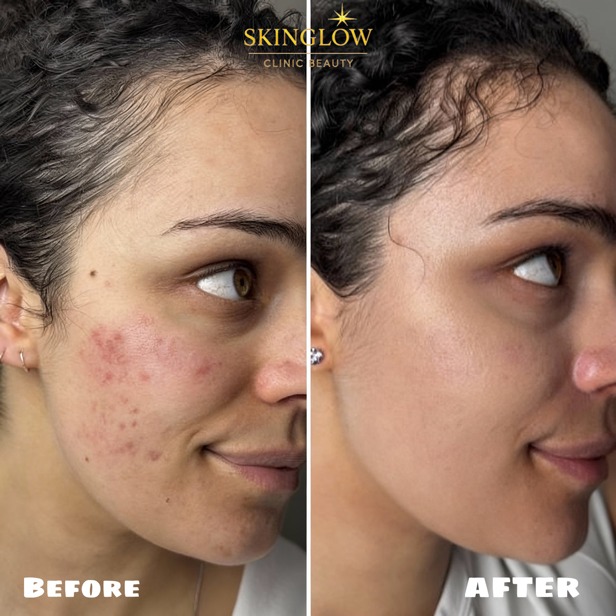 Résultats avant et après traitement