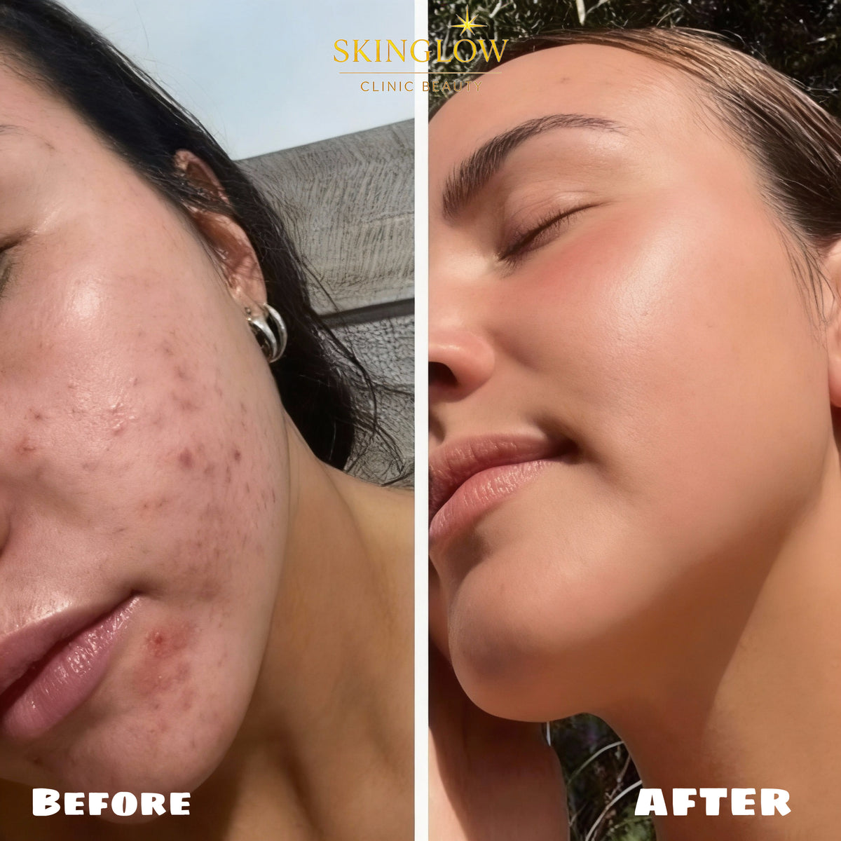 Résultats avant et après traitement